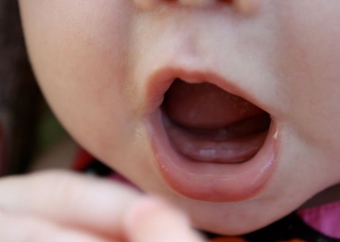 Trẻ 4 tháng mọc răng có sao không?
